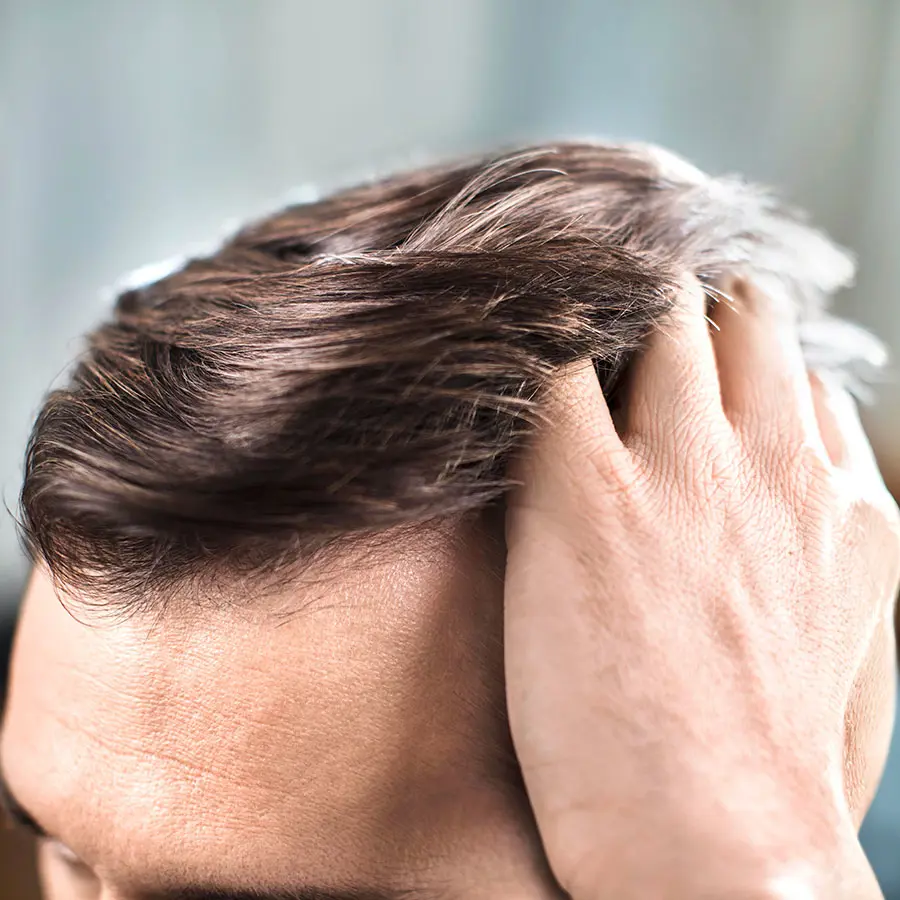 Hvordan sikrer du en smuk og sund hovedbund?